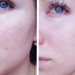 لیکوئید لایه بردار و ضد جوش سر سیاه کوزارکس Cosrx BHA Blackhead Power Liquid 100Ml - Image 4